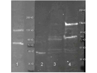 Western Blot: Adenosine Deaminase/ADA Antibody [Biotin] [NBP1-77710] - Mouse pancreas lysate (Left, Lane 1, 30 ul) under reducing conditions. The antibody was also used in whole cell lysate from Jurkat and Raji cells or 3% BSA.